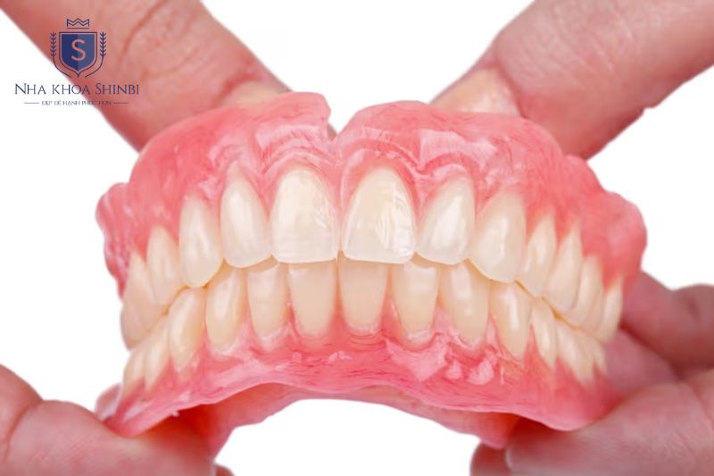 Hàm tháo lắp từng phần là lựa chọn chi phí thấp nhất