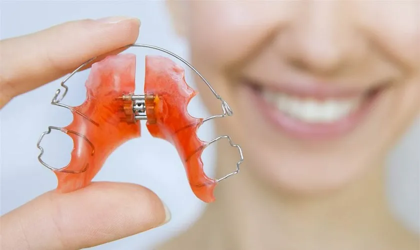 30 câu hỏi FAQ niềng răng - Bác sĩ chỉnh nha giải đáp nhanh cho bạn 