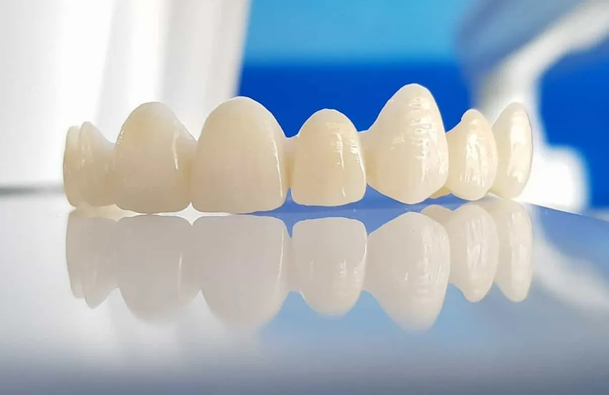 Răng sứ DDBio Đức: bảng giá & cảm nhận thực tế