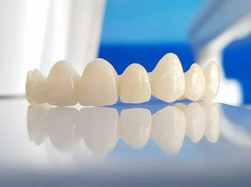 Răng sứ thẩm mỹ cao cấp – Đẹp tự nhiên, ăn Tết trọn vẹn