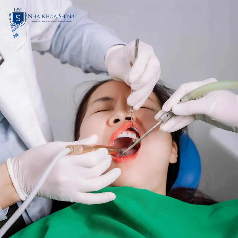 Răng sứ thẩm mỹ cao cấp – Đẹp tự nhiên, ăn Tết trọn vẹn