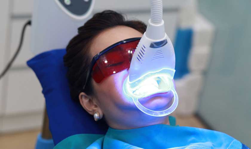 Địa chỉ tẩy trắng răng giờ nghỉ trưa cho dân văn phòng Trần Hưng Đạo