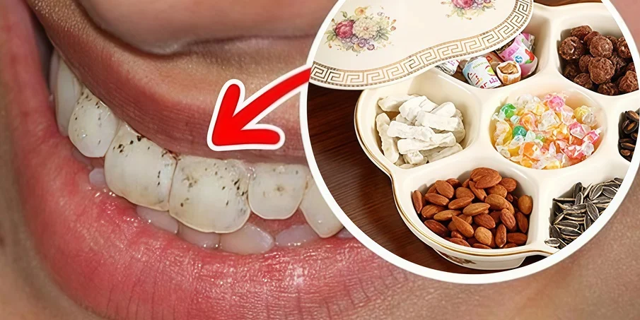 Ăn bánh mứt ngày Tết thế nào để không hỏng răng?