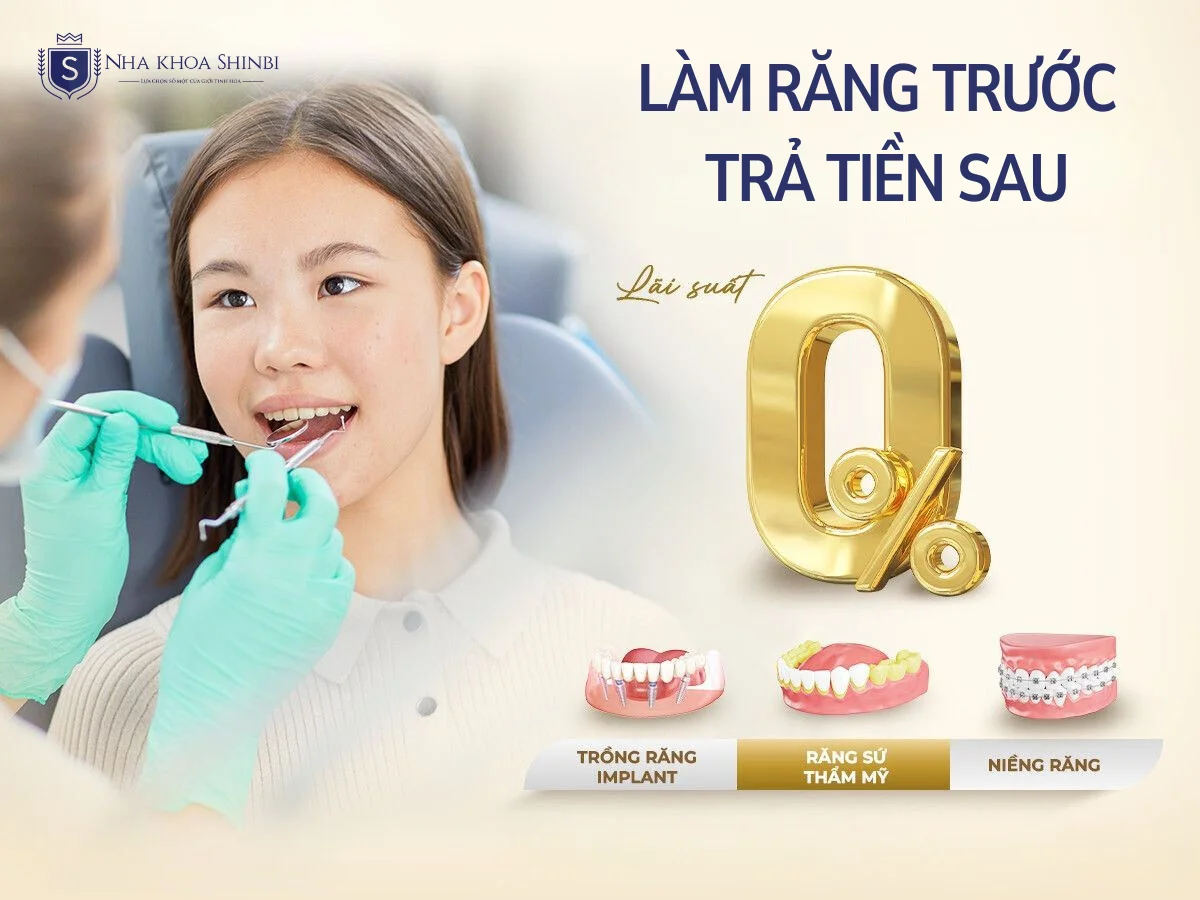 Có nên làm răng sứ trả góp? Giải pháp tài chính thông minh cho người bận rộn