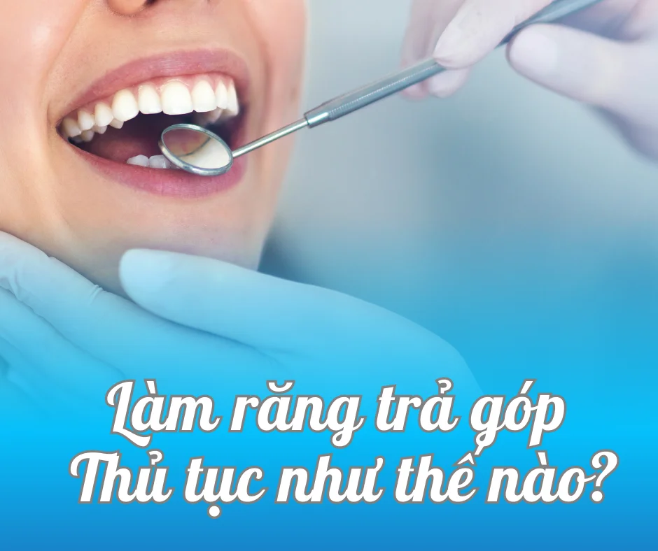 Hướng dẫn chi tiết thủ tục làm răng trước trả tiền sau tại Shinbi
