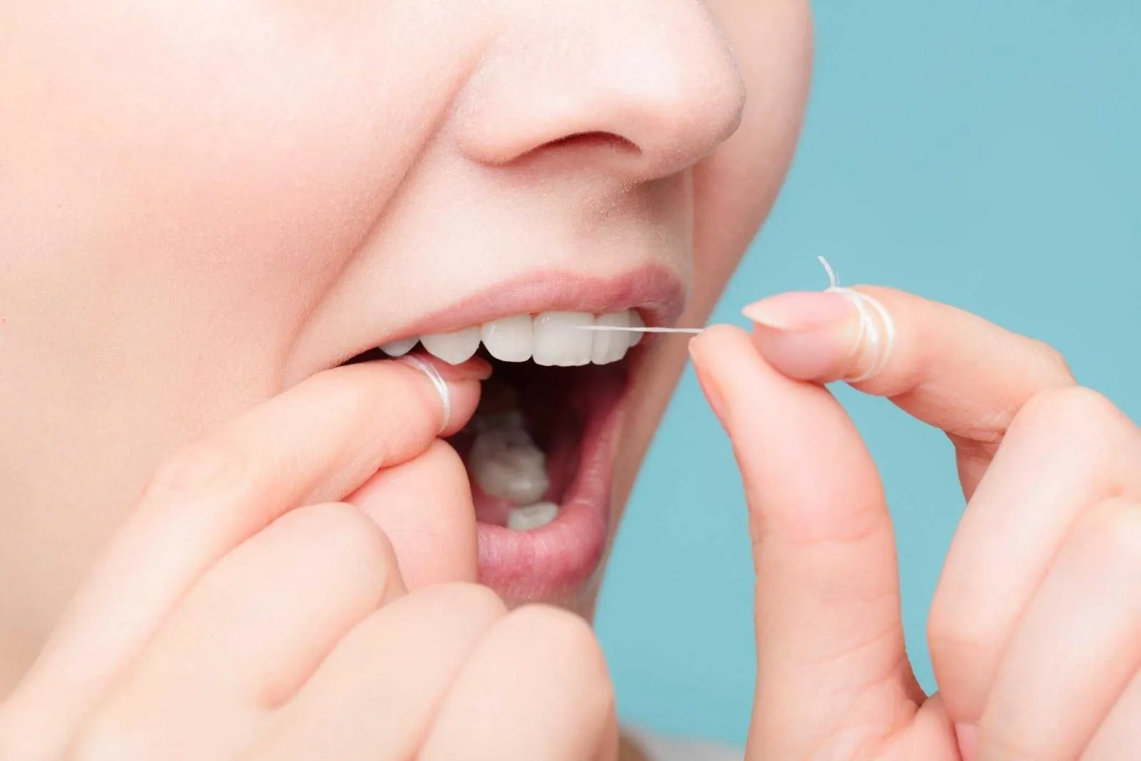 Người đang bọc răng sứ cần lưu ý gì khi ăn uống ngày Tết?