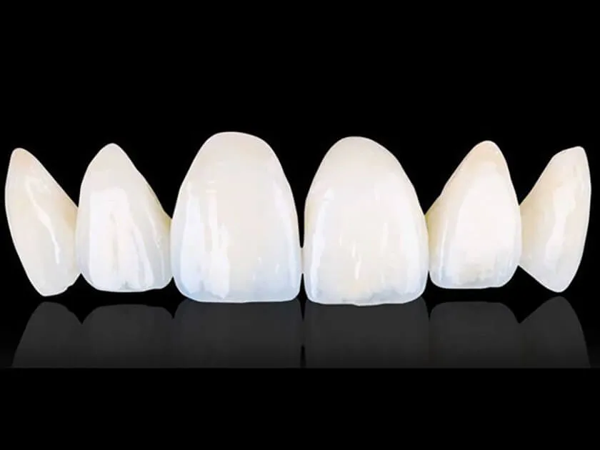 Răng sứ Orodent, Lava Plus, Cercon HT là gì? Tại sao lại đắt?