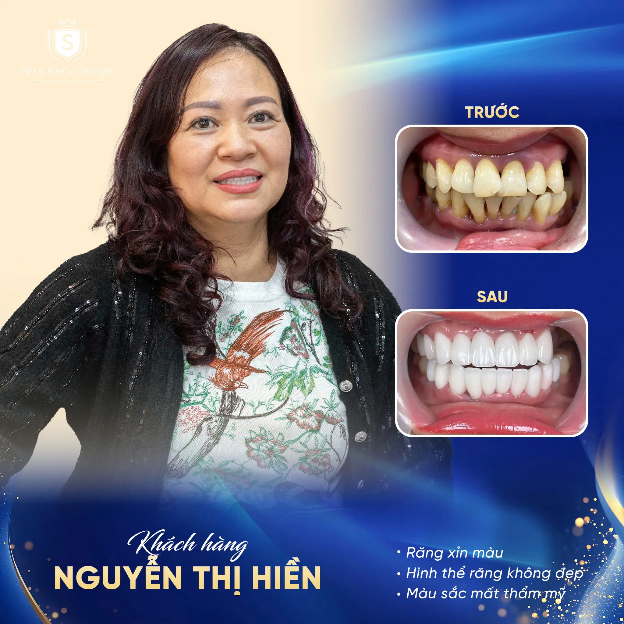 Trả góp nha khoa là gì? Những dịch vụ nào được áp dụng tại Shinbi?