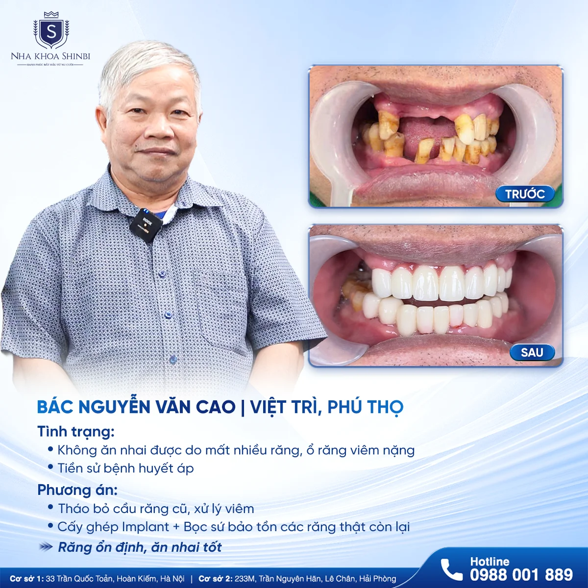 Trả góp nha khoa là gì? Những dịch vụ nào được áp dụng tại Shinbi?