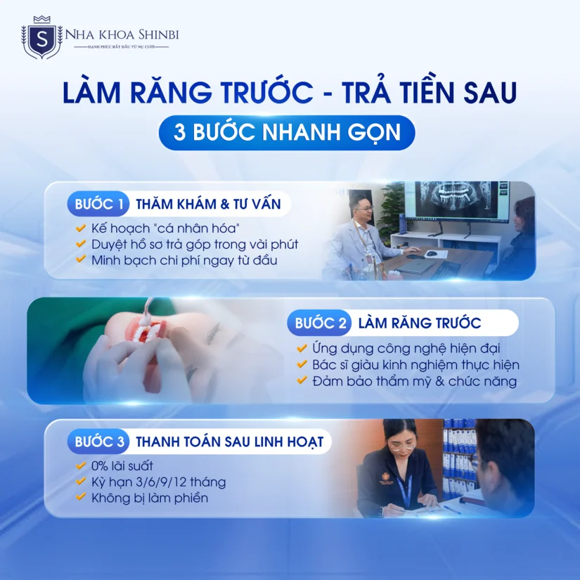 Làm răng trả góp: Mọi điều bạn cần biết trước khi thực hiện