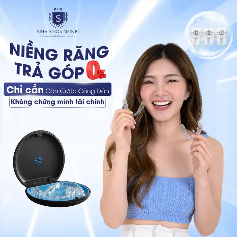 Niềng răng mắc cài sứ: ưu nhược điểm & mức giá cập nhật