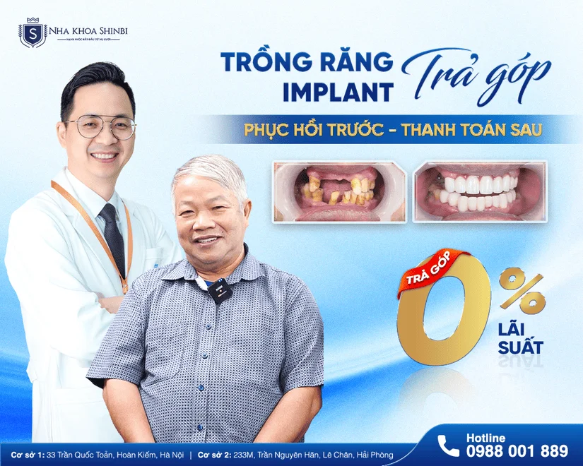 Shinbi Dental - Nha khoa uy tín gần Hồ Thiền Quang (Nguyễn Du)