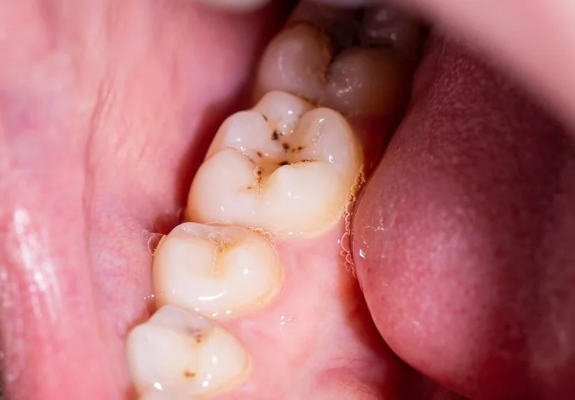 Shinbi Dental - Nha khoa uy tín gần Hồ Thiền Quang (Nguyễn Du)