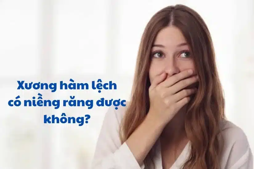 Xương hàm lệch có niềng răng được không?