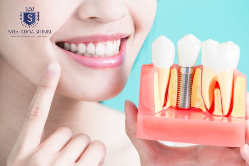 Biotem phù hợp với người mất răng đơn lẻ hoặc vài răng rời rạc