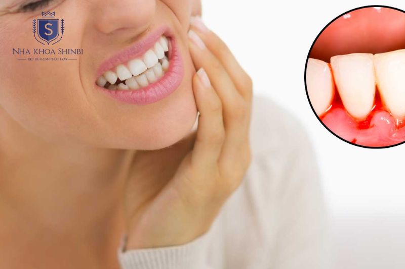 Cần đến nha khoa khi chảy máu kéo dài tái phát hoặc kèm sưng đau sốt