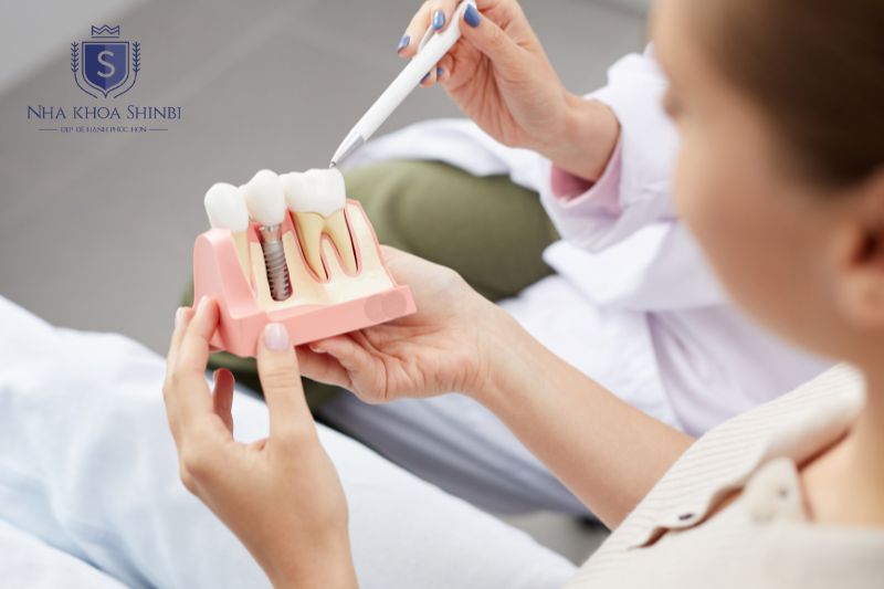 Chăm sóc Implant đúng cách giúp ngăn viêm quanh trụ và duy trì độ bền lâu dài
