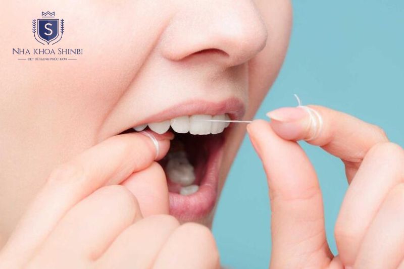 Chỉ nha khoa và lấy cao răng định kỳ giúp phòng ngừa viêm nha chu hiệu quả
