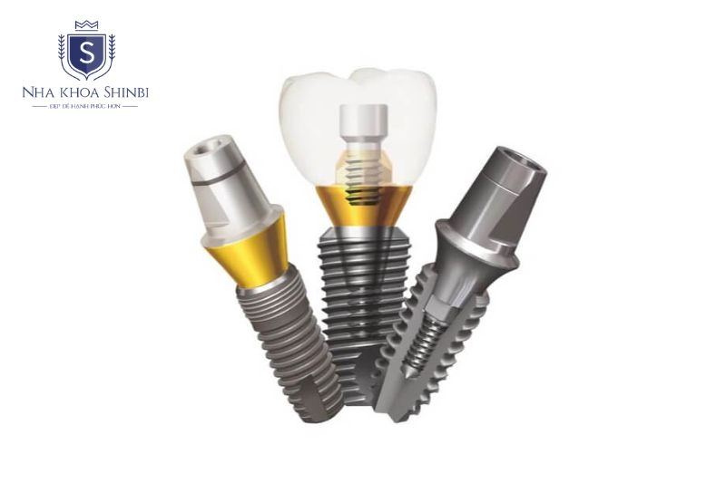Chọn trụ Hàn Quốc cần đảm bảo xuất xứ, chứng nhận, bảo hành và phù hợp lâm sàng
