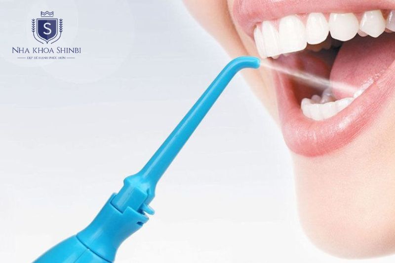 Đánh răng đúng cách dùng chỉ nha khoa và lấy cao răng giúp ngừa chảy máu nướu