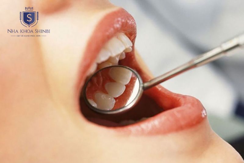 Duy trì tái khám và vệ sinh đúng cách giúp kiểm soát viêm nha chu lâu dài