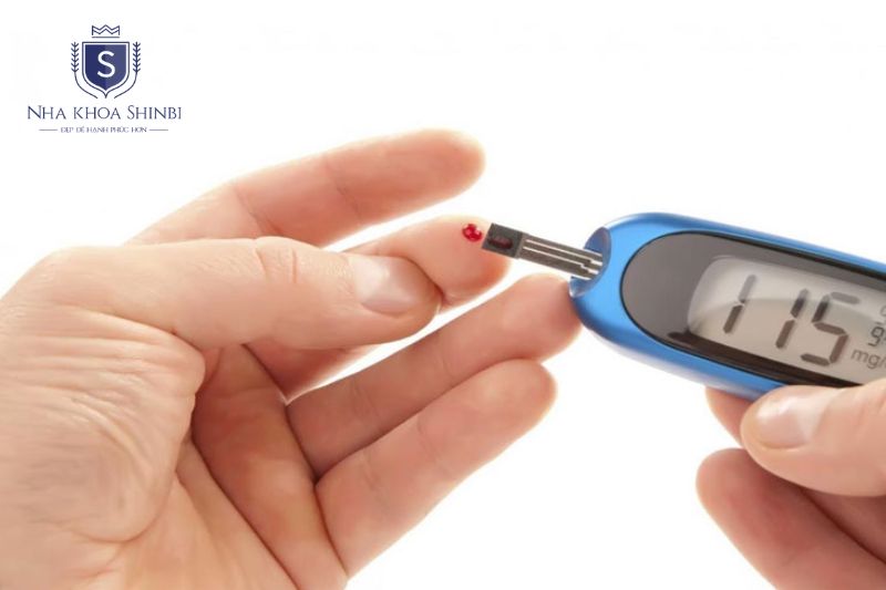 Hút thuốc và tiểu đường làm tăng nguy cơ viêm nha chu nghiêm trọng hơn