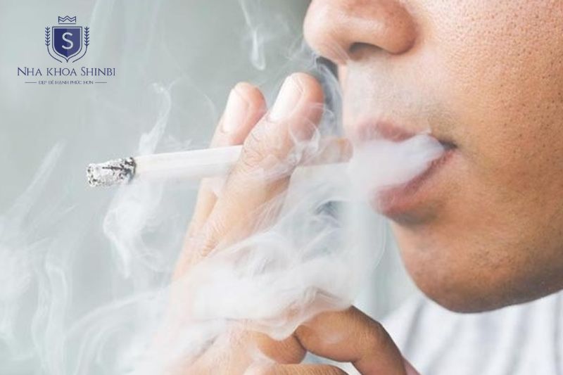 Hút thuốc và tiểu đường làm tăng tốc độ tiến triển viêm nha chu nặng