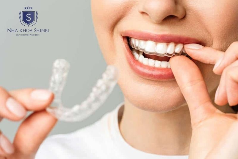 Invisalign thường chỉ gây căng tức nhẹ vài ngày đầu sau khi thay khay mới