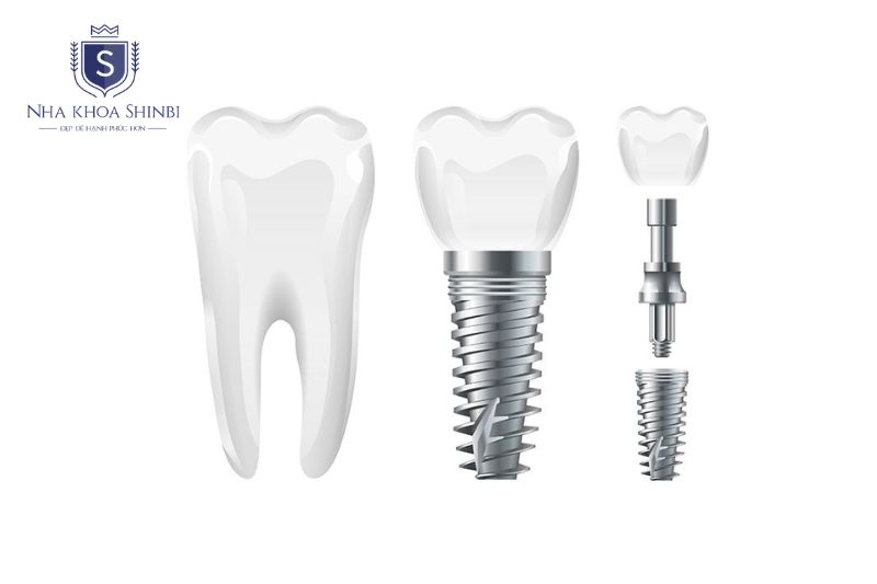 Mỗi dòng trụ Mỹ phải vượt qua thử nghiệm lâm sàng đa trung tâm