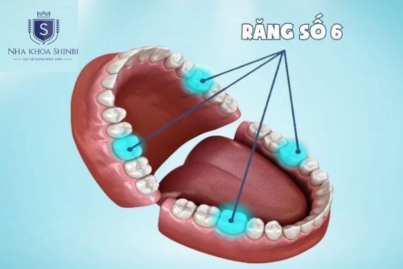 Răng số 6 là răng vĩnh viễn quan trọng giữ lực nhai và ổn định khớp cắn toàn hàm