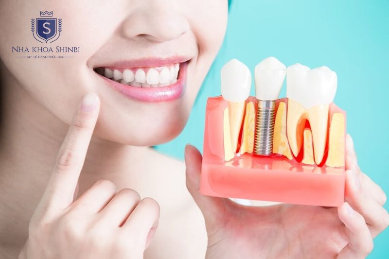 Trồng răng Implant có nhiều ưu điểm như ăn nhai chắc chắn, ngăn tiêu xương và thẩm mỹ tự nhiên lâu dài