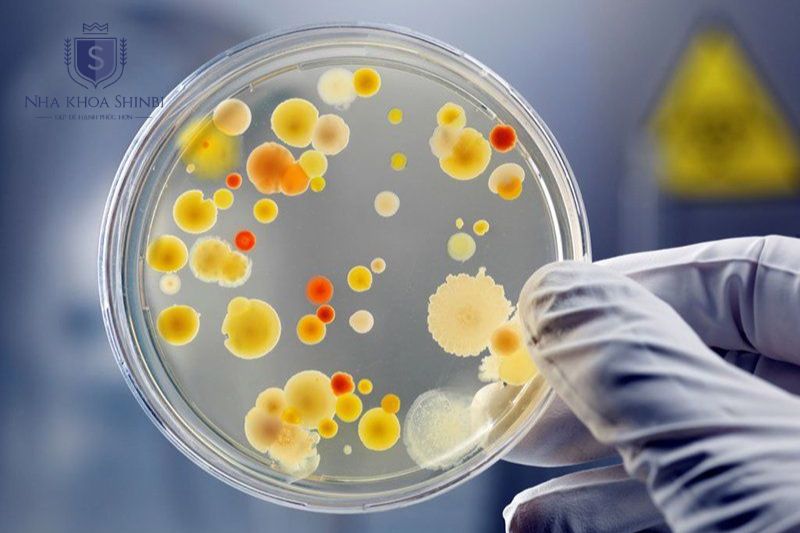 Xét nghiệm vi khuẩn dành cho ca nặng hoặc không đáp ứng điều trị chuẩn