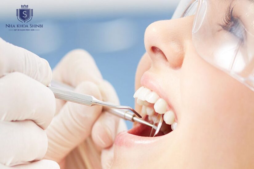 Loại bỏ răng khôn để tránh ảnh hưởng răng bên cạnh