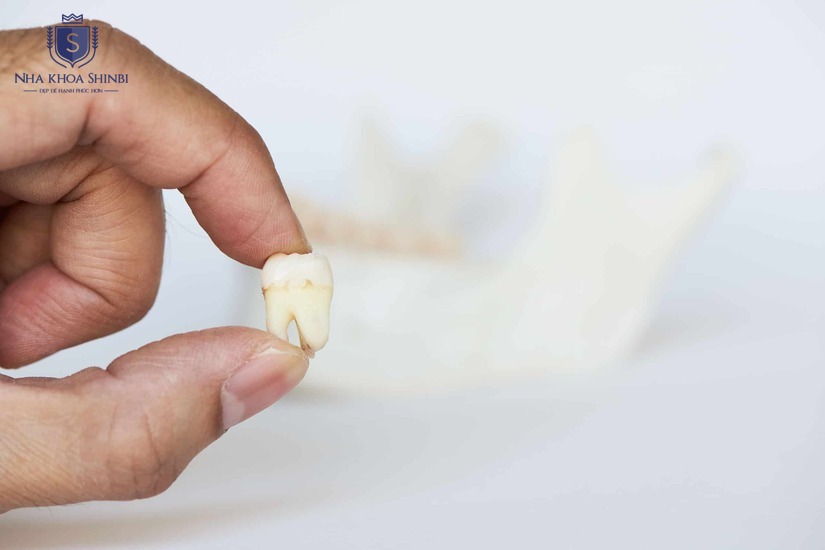 Vệ sinh kỹ lưỡng giúp giảm nguy cơ nhiễm trùng