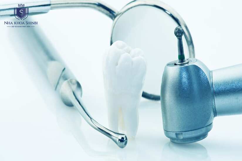 Nhổ răng khôn với mức chi phí hợp lý và minh bạch