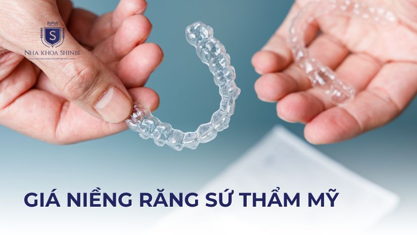 Niềng răng sứ thẩm mỹ giá bao nhiêu cho một liệu trình làm