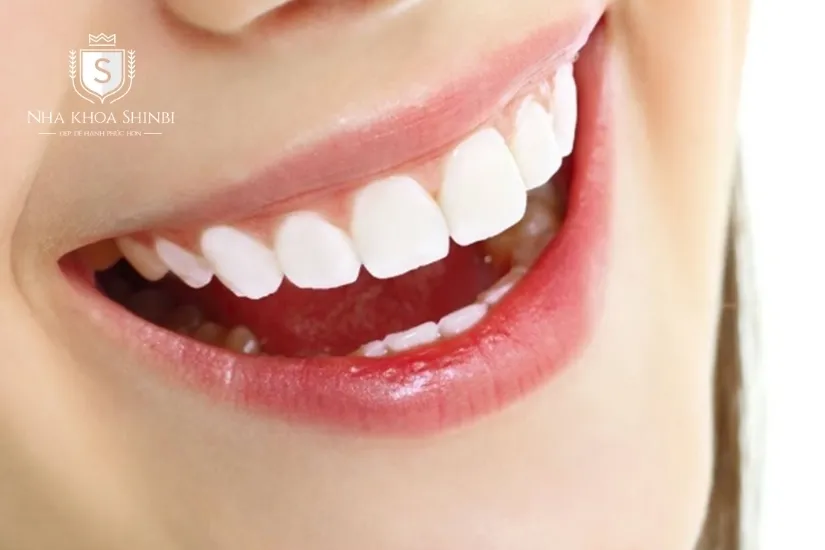 Đảm bảo tính thẩm mỹ Đảm bảo tính thẩm mỹ