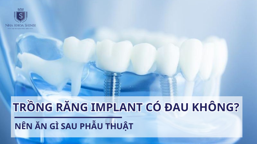 Trồng răng implant có bị đau không? Nên ăn gì sau phẫu thuật