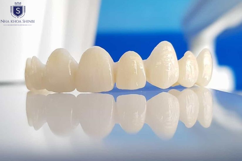 Răng sứ lava rất phổ biến hiện nay