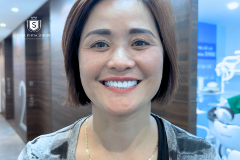 Bọc răng sứ Zirconia có tốt không? 