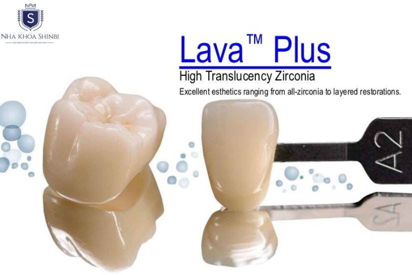 Bọc răng sứ Lava Plus 3M ESPE