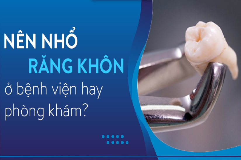 Tại sao nên chọn nhổ răng khôn có bảo hiểm tại nha khoa Shinbi? Tại sao nên chọn nhổ răng khôn có bảo hiểm tại nha khoa Shinbi?