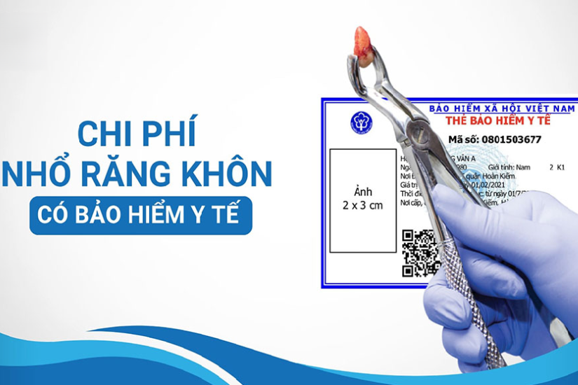 Chi phí nhổ răng khôn có được bảo hiểm chi trả không? Chi phí nhổ răng khôn có được bảo hiểm chi trả không?