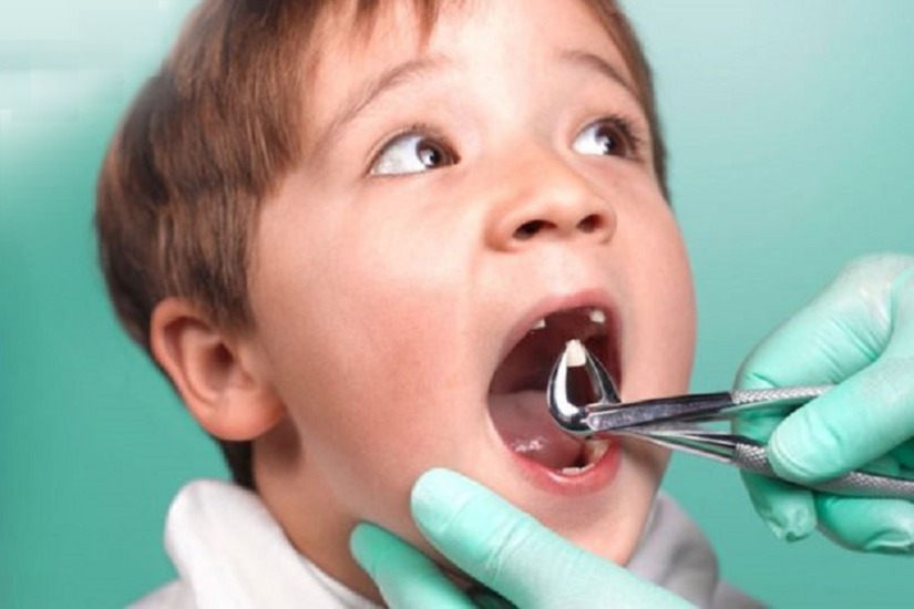 Nhổ răng trẻ em miễn phí - Ưu đãi lớn tại nha khoa Shinbi Nhổ răng trẻ em miễn phí - Ưu đãi lớn tại nha khoa Shinbi