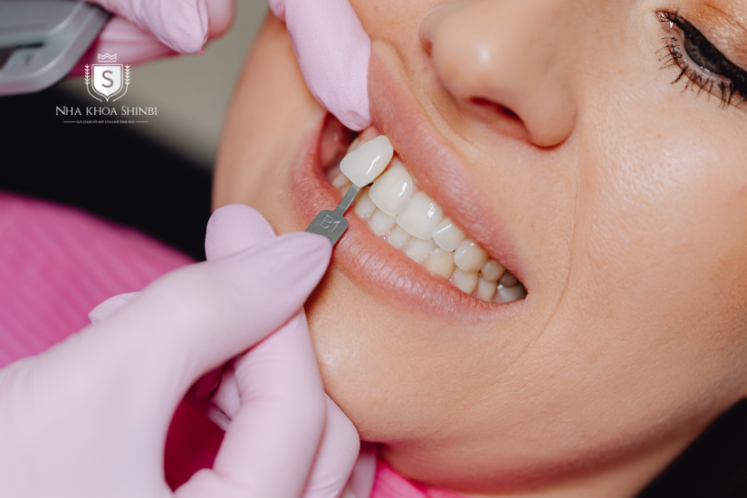 Khi răng sứ bị rơi, bạn cần đến gặp bác sĩ nha khoa để xử lý Khi răng sứ bị rơi, bạn cần đến gặp bác sĩ nha khoa để xử lý