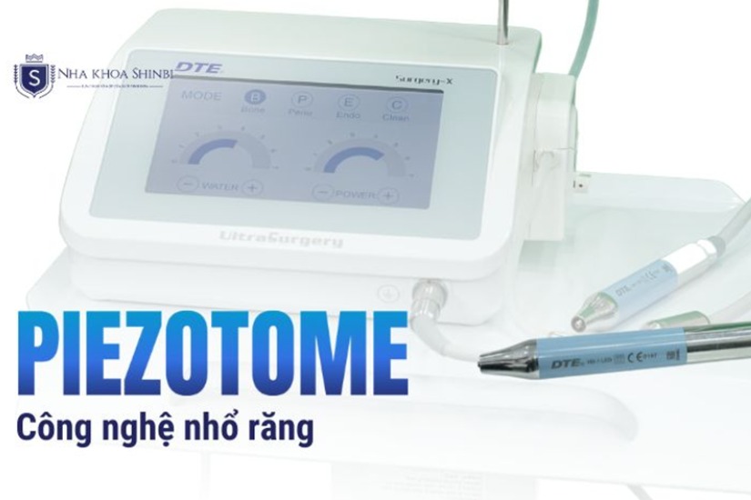 Tiến hành nhổ răng bằng các công nghệ máy móc hiện đại Tiến hành nhổ răng bằng các công nghệ máy móc hiện đại