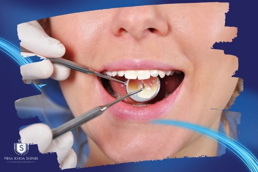 Khám và kiểm tra kỹ tình trạng răng miệng Khám và kiểm tra kỹ tình trạng răng miệng