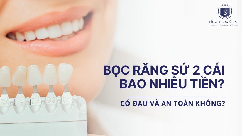 Bọc răng sứ 2 cái bao nhiêu tiền? Có đau và an toàn không?