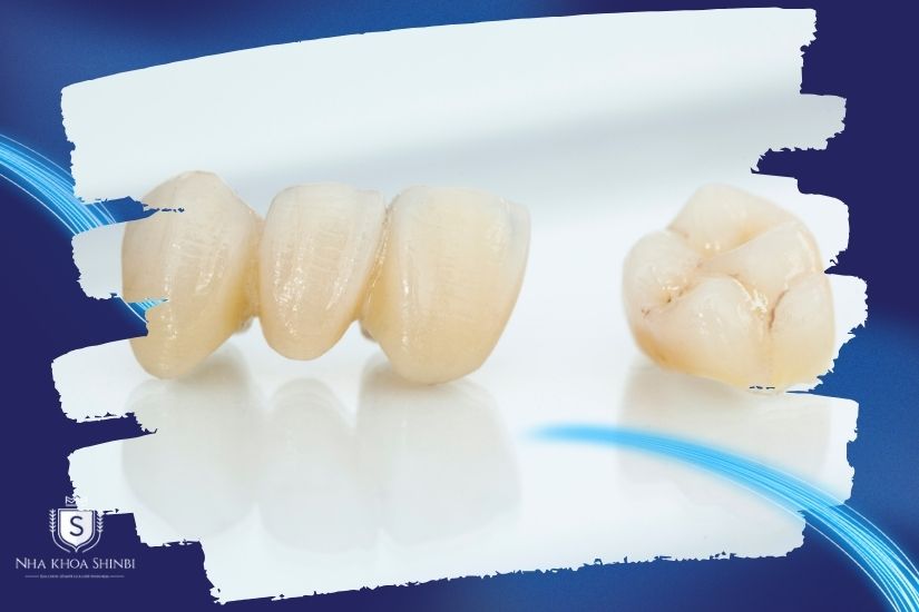 Phục hình răng sứ thẩm mỹ Bọc răng sứ thẩm mỹ