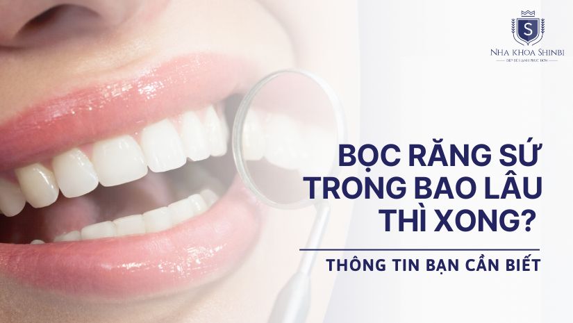Bọc răng sứ trong bao lâu thì xong? Thông tin bạn cần biết